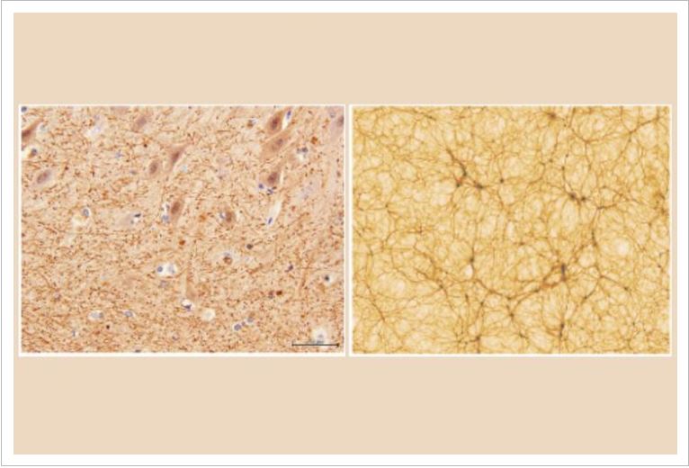 One of These Pictures Is the Brain, the Other is the Universe. Can You Tell Which is Which?